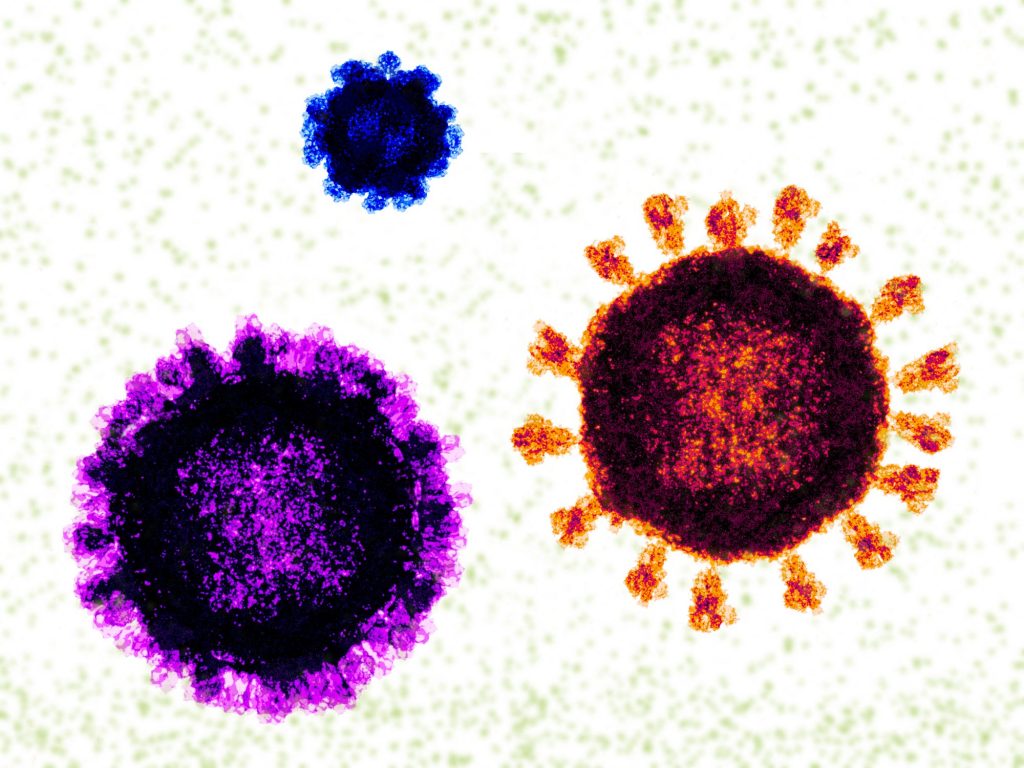 A large flu strain may have died from the coronavirus pandemic
