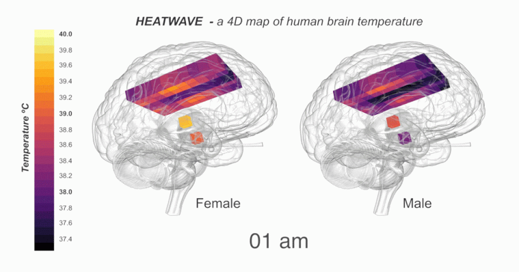 Index - Tech-Science - The brain heats up when it spins